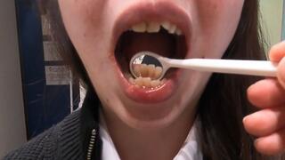 Real Amateur – Beautiful Married Woman’s Detailed Dental Checkup (Extreme Mouth Close-Up)