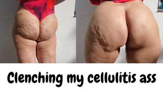 CLENCHING MY CELLULITIS ASS