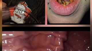 Digested By Sloane! ENDOSCOPIC SCENES