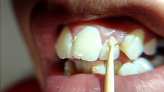Cleaning my teeth with a wooden toothpick after 15 days without brushing (full version) close-up of the toothpick