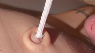 Navel pulling with glue