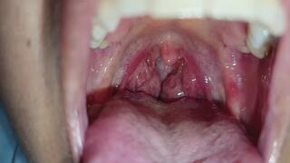 Amígdalas grandes: abro mi boca y muestro el interior de cerca