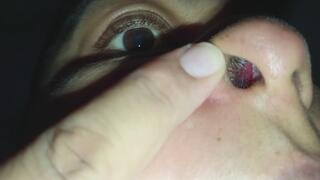 Mostrando el interior de mi nariz _ pelitos y mocos de cerca.