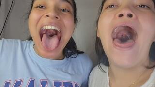 We'll let you observe our uvulas