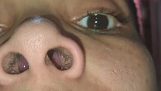 Inside my nose