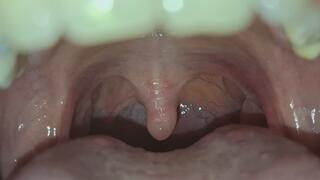 And this uvula?