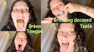 Brushing decayed teeth and green tongue