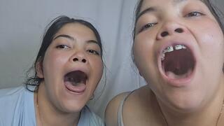 “Open Your Eyes Wide: Our Throat and Uvulas in Close-Up”