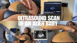 Ultrasound scan of an alien baby