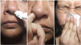 Trying to Blow My Nose – Stubborn Booger Check