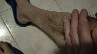 Wounds and scars on my legs and belly