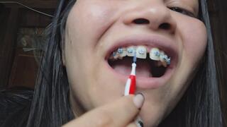 “POV: I’ll show you my braces and how I clean them up close