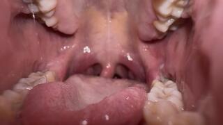 Exploring My Mouth Uvula Close-Up copy