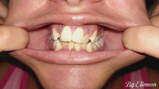 Showing you my teeth in the morning (close-up). Unbrushed teeth in the morning. Dirty natural teeth. (Video without audio)