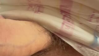 SAFS plaster cast, Hot moments