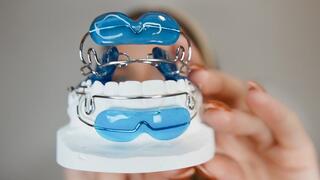 Try on: Activator with Tongue Crib & Lip Bumpers