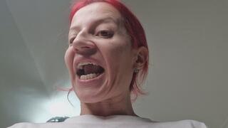 Heavy Coughing Fetish – Deep Lung Cough & Spit In Your Mouth