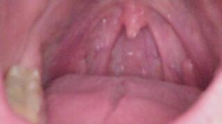 I paralyze you with my beautiful eyes and eat you vore style