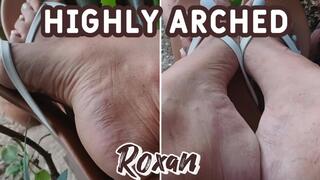 What magnificent pronounced arches on the feet of a woman in flip flops (3)