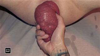 arty boer and prolapsiboy.