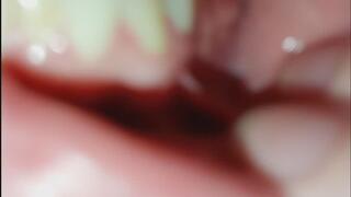 Extreme oral exploration