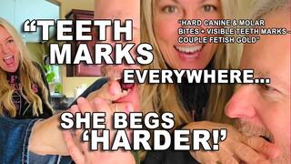 Hard Toe Biting + Finger & Arm Biting by Real Couple Tyler Girl & Tyler Boy – Teeth Marks & Playful Pain!