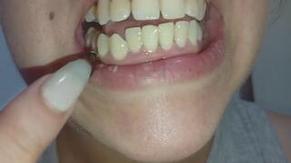 Lola's mouth un Bad condition