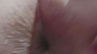 Butt Hole upclose