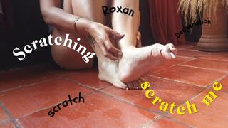Roxan scratching her feet because it is itchy (3)