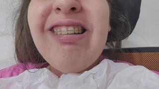 Retainers & Drooling Compilation: Chubby Girl Wearing Retainers and Drooling POV