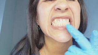 Close-ups of my teeth and mouth