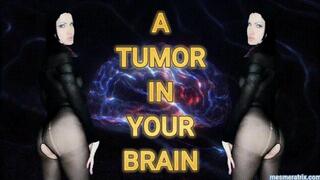 A TUMOR YOUR BRAIN