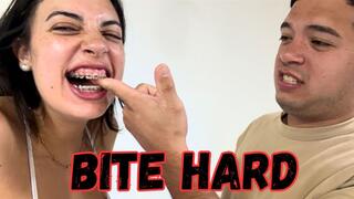 Biting my roommate’s hands and arms until my teeth marks are left on him.