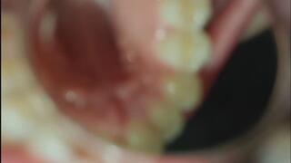 Oral examination with a cosmetic mirror