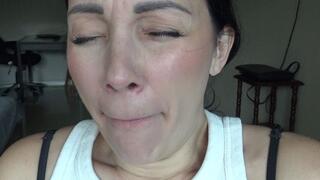 yawn with a white coating