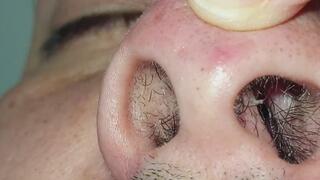 Dentro de mi nariz... Pelitos, mocos y primer plano.