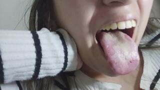 My tongue is white, cracked, and defective.