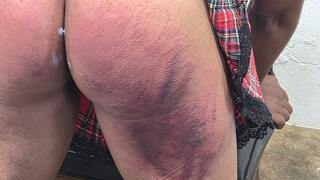 When the Strap Comes Down