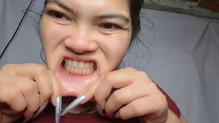 Crazy Stretching of My Lower and Upper Lips