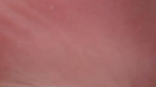 The soles of my defective feet