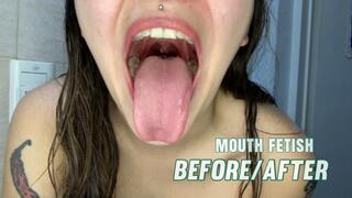 Before & After Mouth Close-Up – Uvula, Tongue & Teeth Brushing POV
