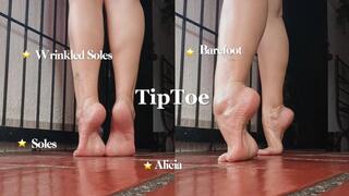 Walks on tiptoe holding all his weight and showing wrinkled soles (2)