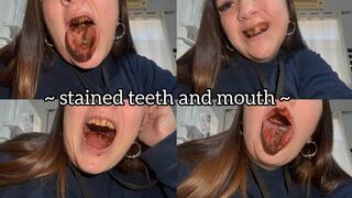 Stained teeth and mouth