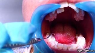 Using a dental probe for the first time! Dental checkup!