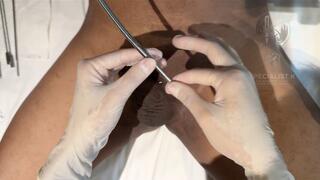 6mm Hegar Dilation & Systemic Calibration | Log 09: Solid-Core Urethral Displacement | Specialist K