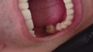 My teeth and tongue