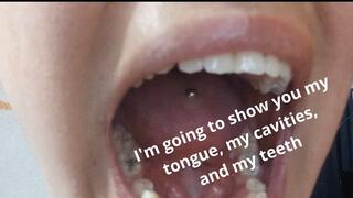 I'm going to show you my tongue, my cavities, and my teeth