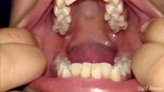 Let's play inside my mouth, I invite you to come in!