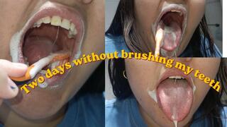 Brushing my teeth after two days