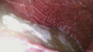 [FHD 60FPS] - Dangerous insides -'w'- - ENDOSCOPE VORE